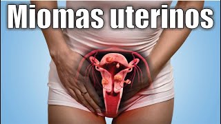 DOLOR pélvico, SANGRADO abundante, ORINA constante 🥵 MIOMAS UTERINOS o FIBROMAS ⭐ Dr CARLOS ZUÑIGA