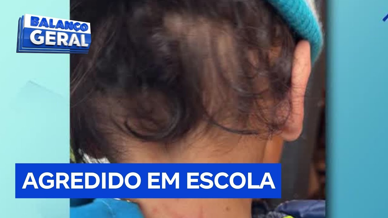 Família percebe marcas em criança e descobre agressões pelas câmeras de segurança da escola