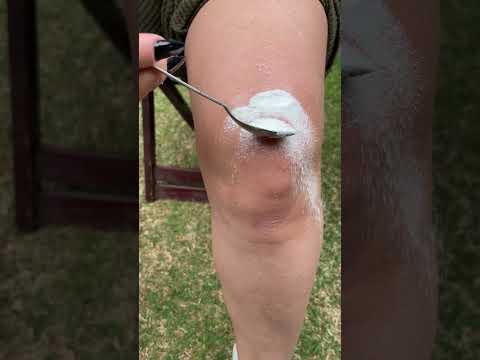 Depois que aprendi as utilidades do Vick Vaporub, nunca mais fiquei sem!