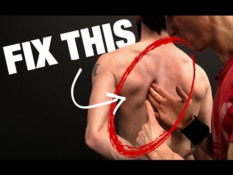 How to Fix Scapular Winging (STEP BY STEP!)