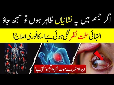 Cure and Recognition of Evil Eye! | Evil Eye Protection In Islam | Islamic Teacher