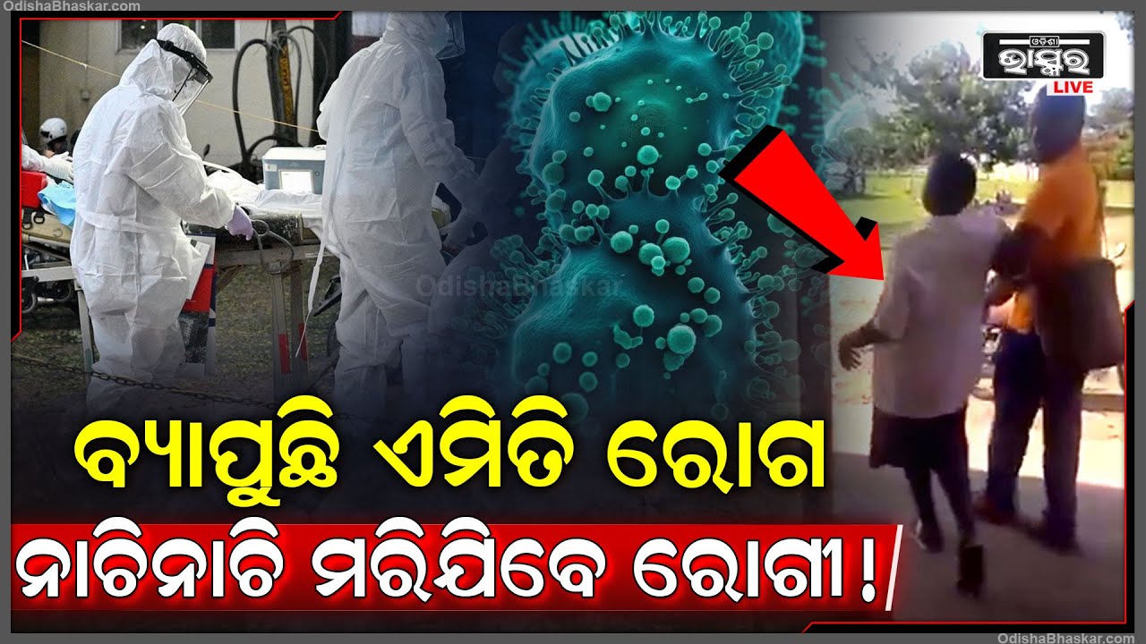 ହୁ ହୁ ହେଇ ବ୍ୟାପୁଛି ଅଜବ ରୋଗ...ରୋଗରେ ପଡିଲେ ରୋଗୀ କରୁଛନ୍ତି ଡ୍ୟାନ୍ସ, ଯାହାକୁ ଦେଖି ଆଶ୍ଚର୍ଯ୍ୟ ହେଲେଣି ଡାକ୍ତର