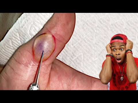 Painful Things And We Can All Relate To