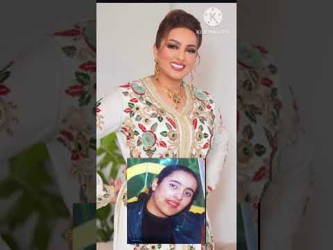 زينة الداودية قبل و بعد الشهرة و التجميل 😍❤️