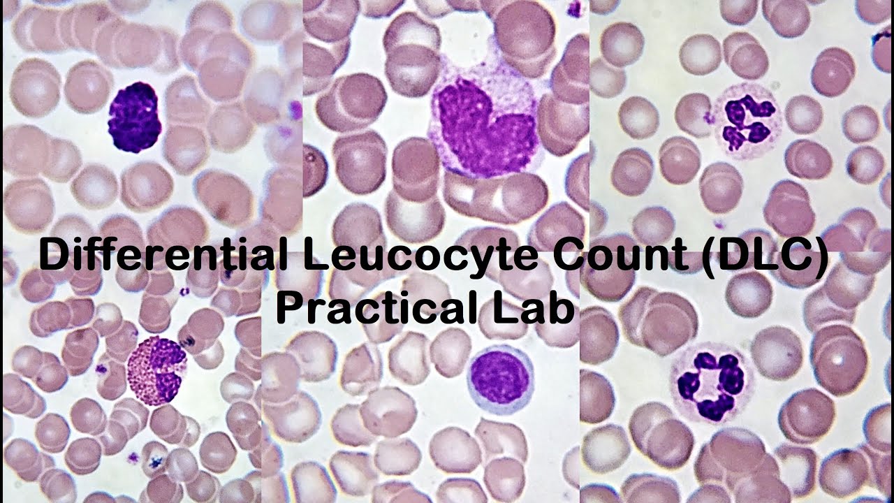 Differential White Blood Cell Count Virtual Lab: A Revolutionary Approach to Medical Education