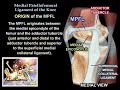 Medial Patellofemoral Ligament Functions