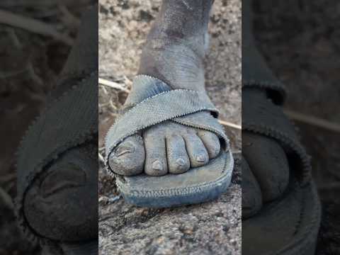 Chaba's leg. #africa #viral #shorts