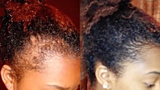Bald Spot And Thinning Edges Videos Kansas City Comic Con