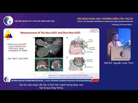 4. Vai trò của CT tim mạch trong thay van hai lá qua ống thông (BS.CKII. Nguyễn Xuân Trình)
