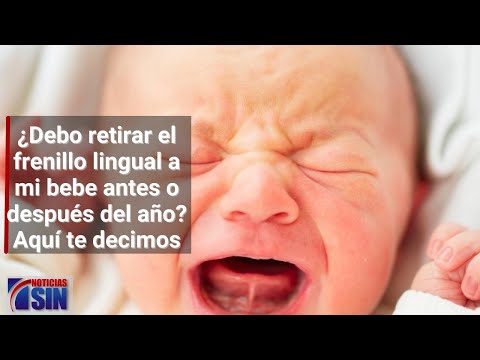 ¿Debo retirar el frenillo lingual a mi bebe antes o después del año? Aquí te decimos