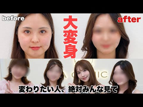 【視聴者整形企画】変わりたい人、悩みがある人必見です‼️‼️