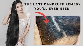 How to Get Rid Of Dandruff Effectively THAT WORKS! (Backed by My Dermatologist)