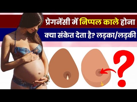 प्रेगनेंसी में निप्पल काले होना किस बात का संकेत देता है | Baby Gender Prediction using Nipple