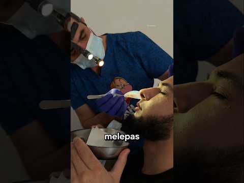 Benda Aneh di Hidung Pasien