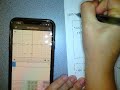 Key Features of Quadratic Functions Explored