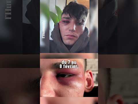 Homophobie : un arbitre agressé chez lui après une demande en mariage