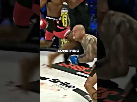 How MVP Broke His Skull 💀