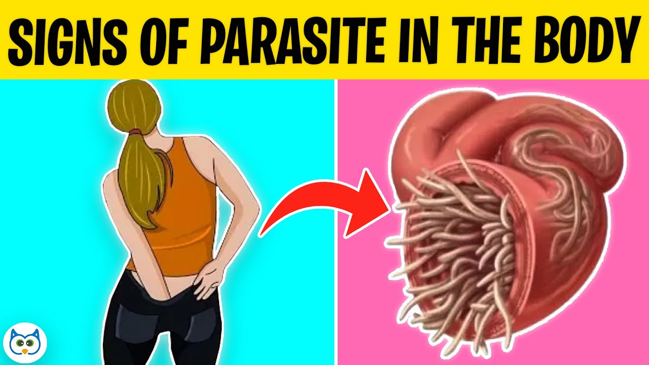 10 WARNING signs you could have a PARASITE in your body