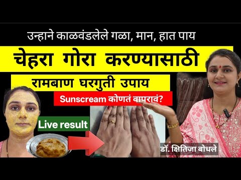 चेहऱ्याचा काळेपणा त्वरित दूर करणारा रामबाण उपाय,Live result पाहा,Sunscream कोणतं वापरावं?Skinglow