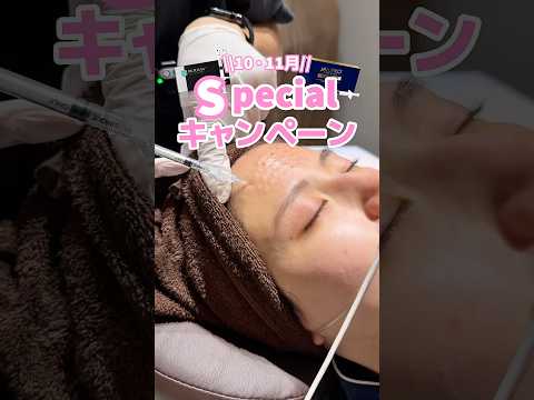 お得キャンペーン🉐♥️ #全身麻酔 #肌質改善 #肌管理 #キャンペーン #shorts