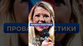 НЕУДАЧНАЯ пластика, которая изменила жизнь звезды Голливуда! #ТараРид #Пластика