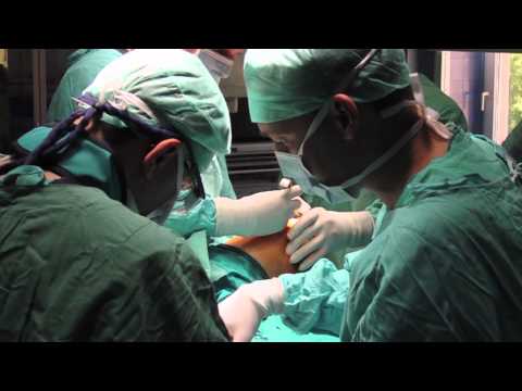 Mesothelioma Treatment Options