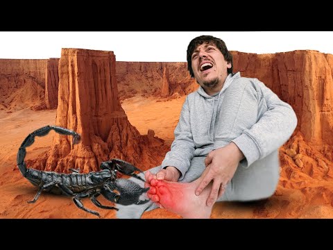 لدغتني عقرب في أجمل جبال الجزائر 🦂😨 - Stung by a Scorpion
