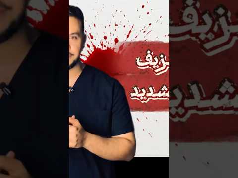 أزاي توقف النزيف؟