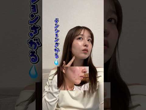 【肌荒れ】急にニキビ大量発生😭😭 #shorts