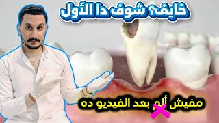 ضرس العقل بيعملك مشاكل؟ اسمع الكلام ده قبل ما تخلعه