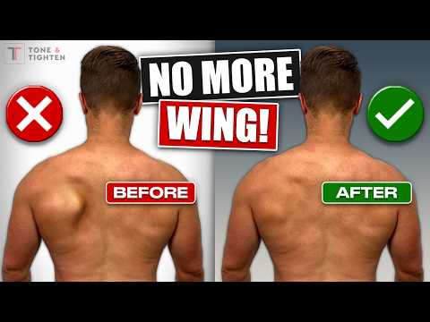 Fix Scapular Winging FOR GOOD! [Shoulder Blade Exercises]