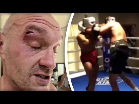 [leaked video]  tyson fury cut in sparring! Usyk fight cancelled!