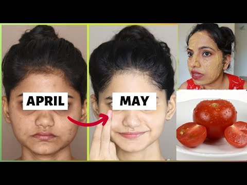 ಬೆಳ್ಳಗಾಗಲು ಟೊಮೇಟೊ ಫೇಷಿಯಲ್ |Skin Brightening Tomato Facial, Skin Brightening ,Whitening ,Glowing Tips