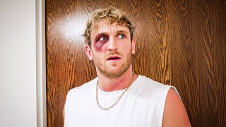 I Got Punched In The Face **Not Clickbait**