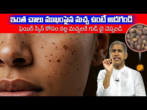 ఫెయిర్ స్కిన్ కోసం నల్ల మచ్చలకి గుడ్ బై చెప్పండి! | Face Glowing | Dr Manthena Satyanarayana Raju