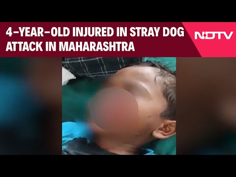Maharashtra News | 4-Year-Old Injured in Stray Dog Attack in Maharashtra's Bhandara District