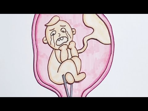 loss of a child 🥺#shorts#drawing#cartoon#story#xiaolindrawing#animation#art