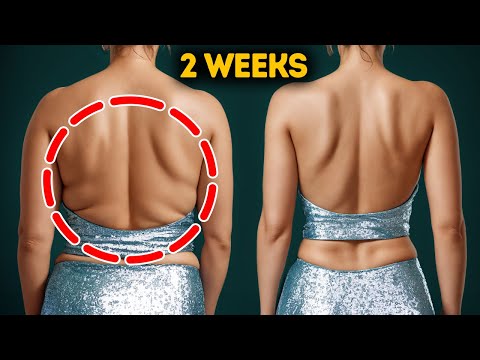 Quick & Easy Back Fat Workout & Eliminate Bra Bulge Fast