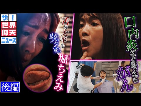 治らない口内炎…実はステージ４のがんだった　舌の大半を失った堀ちえみ（後編）【ザ！世界仰天ニュース】