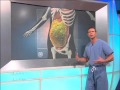 Health Effects of Fast Food Consumption