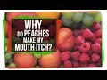 Understanding Oral Allergy Syndrome