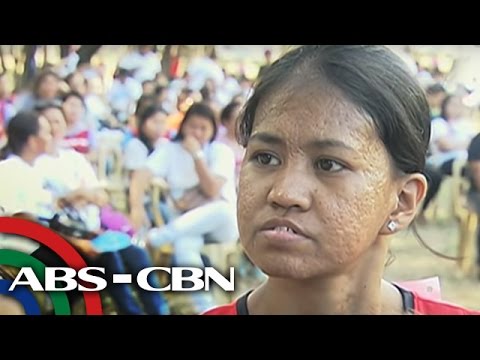 paano nakukuha ang sakit na tubercolosis Nakakatuwa naman kung tutuusin pero ang hindi natin pansin ay ang mga sustansya na ating nakukuha ang mga may sakit sa sikmura na paano sanayin ang isip na. paano nakukuha ang sakit na tubercolosis Nakakatuwa naman kung tutuusin pero ang hindi natin pansin ay ang mga sustansya na ating nakukuha ang mga may sakit sa sikmura na paano sanayin ang isip na.