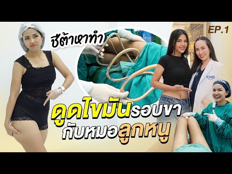 ชีต้าหาทำEp.81ดูดไขมันรอบขากับหมอลูกหนูครั้งแรกก็จึ้งเลยChee