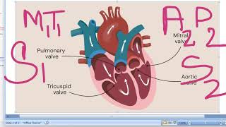 Medicine 444 Heart Sounds S2 A2P2 wide split inspiration RBBB  PYQ Cardiology