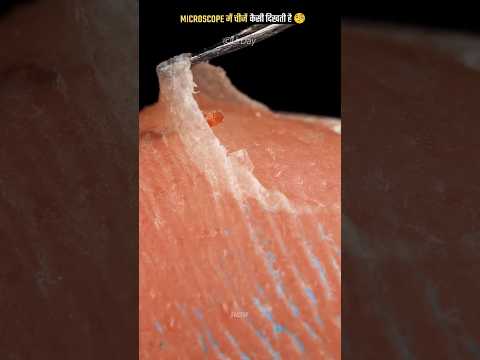 MICROSCOPE में चीजें कैसी दिखती है 🧐#shorts #facts #factshorts