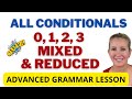 Understanding Conditionals and Their Variations