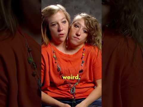 Conjoined Twins Answer the Most Googled Questions