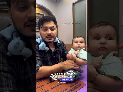 Umbilical hernia. #drimranpatel #drimran #babydoctor