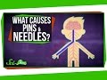 Understanding Paresthesia