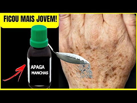 PEELING DE MÃO, SOME RUGA DOS BRAÇOS, MÃOS E PESCOÇO